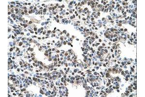 Image no. 1 for anti-Advanced Glycosylation End Product-Specific Receptor (AGER) (AA 251-300) antibody (ABIN6736617) (RAGE 抗体  (AA 251-300))