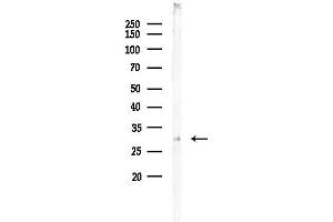 anti-GDNF Family Receptor alpha 4 (GFRA4) (Internal Region) antibody