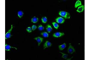 Immunofluorescence staining of A549 cells with ABIN7127407 at 1:51, counter-stained with DAPI.