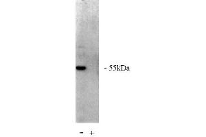 Image no. 1 for anti-Protein Phosphatase 2, Regulatory Subunit A, beta (PPP2R1B) antibody (ABIN264940) (PPP2R1B 抗体)