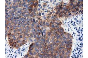 Immunohistochemical staining of paraffin-embedded Human pancreas tissue using anti-ALDH1L1 mouse monoclonal antibody. (ALDH1L1 抗体)
