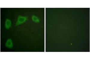 Immunofluorescence analysis of HuvEc cells, using Caveolin-1 Antibody.