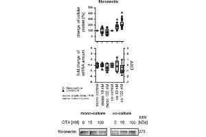 Western Blotting (WB) image for anti-Fibronectin 1 (FN1) antibody (ABIN5596761)