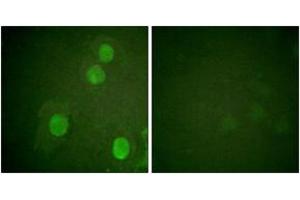 Immunofluorescence analysis of HuvEc cells, using Histone H4 (Phospho-Ser47) Antibody. (Histone H4 抗体  (pSer47))