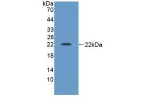 Detection of Recombinant ACVA, Human using Polyclonal Antibody to Activin A (ACVA) (ACVA 抗体  (AA 44-178))