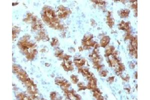 Formalin-fixed, paraffin-embedded rat stomach stained with TNF alpha antibody. (TNF alpha 抗体)