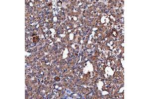 IHC analysis of SCO1 using anti-SCO1 antibody (ABIN7600609).