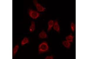 ABIN6275705 staining LOVO by IF/ICC. (ZP1 抗体  (Internal Region))