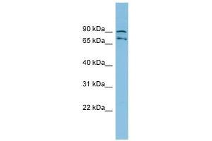 MTRR antibody used at 1 ug/ml to detect target protein. (MTRR 抗体  (N-Term))