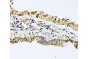 Immunohistochemistry of paraffin-embedded Mouse lung using ATP2C1 Polyclonal Antibody at dilution of 1:100 (40x lens). (ATP2C1 抗体)