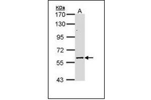 Sample (30 ug of whole cell lysate). (ELP3/KAT9 抗体)