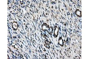 Immunohistochemical staining of paraffin-embedded liver tissue using anti-LOXmouse monoclonal antibody. (LOX 抗体  (AA 22-168))