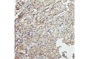 IHC analysis of CETP using anti-CETP antibody (ABIN7602439). (CETP 抗体  (AA 77-353))