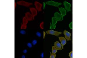 ABIN6259339 and ABIN6275439 staining Hela cells(30 min of UV treatment) by IF/ICC. (RSAD1 抗体  (Internal Region))