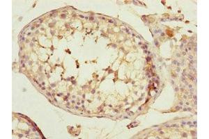 Immunohistochemistry of paraffin-embedded human testis tissue using ABIN7170585 at dilution of 1:100 (SPICE1 抗体  (AA 1-220))