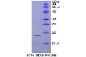 SDS-PAGE (SDS) image for Thyroid Stimulating Hormone, beta (TSHB) (AA 17-134) protein (His tag) (ABIN1080931)