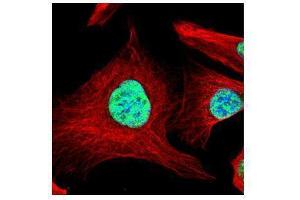 ICC/IF Image Confocal immunofluorescence analysis (Olympus FV10i) of paraformaldehyde-fixed U2OS, using SART1, antibody (Green) at 1:500 dilution.