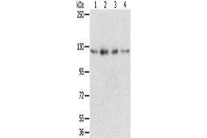 Western Blotting (WB) image for anti-RNA Binding Motif Protein 5 (RBM5) antibody (ABIN2424059) (RBM5 抗体)