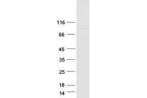 Validation with Western Blot (DGKG Protein (Transcript Variant 3) (Myc-DYKDDDDK Tag))