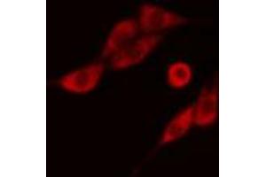 ABIN6274279 staining COLO205 cells by IF/ICC. (NCBP2 抗体  (N-Term))