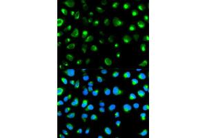 Immunofluorescence analysis of MCF7 cell using GYPC antibody. (CD236/GYPC 抗体  (AA 1-128))