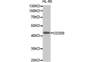 Western Blotting (WB) image for anti-CD209 (CD209) (AA 265-404) antibody (ABIN1679076) (DC-SIGN/CD209 抗体  (AA 265-404))