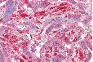 ABIN361189 (2. (DLX5 抗体  (Internal Region))