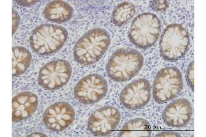 Immunoperoxidase of monoclonal antibody to ACSL5 on formalin-fixed paraffin-embedded human colon. (ACSL5 抗体  (AA 91-186))