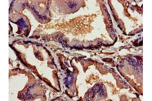 Immunohistochemistry of paraffin-embedded human prostate tissue using ABIN7172109 at dilution of 1:100 (Thymic Stromal Lymphopoietin 抗体  (AA 29-159))