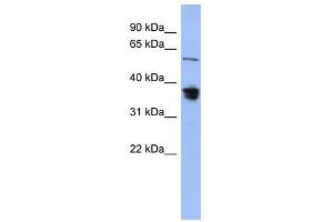 RAD23B antibody used at 1 ug/ml to detect target protein. (RAD23B 抗体)