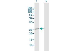 Western Blot analysis of OTUB2 expression in transfected 293T cell line by OTUB2 MaxPab polyclonal antibody. (OTUB2 抗体  (AA 1-234))