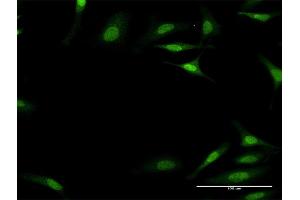Immunofluorescence of monoclonal antibody to PLEC1 on HeLa cell. (PLEC 抗体  (AA 4384-4493))