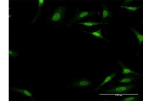 Immunofluorescence of monoclonal antibody to PLEC1 on HeLa cell.