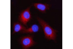 IF analysis of GSDMD using anti-GSDMD antibody (ABIN7599431).