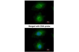 ICC/IF Image Immunofluorescence analysis of paraformaldehyde-fixed HeLa, using MVD, antibody at 1:200 dilution. (MVD 抗体  (Center))