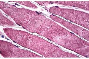 Human Skeletal Muscle: Formalin-Fixed, Paraffin-Embedded (FFPE) (PIM1 抗体  (AA 1-314))