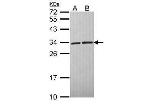WB Image Sample (30 ug of whole cell lysate) A: A431 , B: H1299 12% SDS PAGE antibody diluted at 1:1000 (CACYBP 抗体  (C-Term))