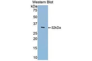 Western Blotting (WB) image for anti-Meningioma Expressed Antigen 5 (Hyaluronidase) (MGEA5) (AA 319-450) antibody (ABIN1859957) (MGEA5 抗体  (AA 319-450))