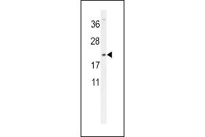 DMRTC1 Antibody (N-term) (ABIN654523 and ABIN2844245) western blot analysis in MDA-M cell line lysates (35 μg/lane). (DMRTC1 抗体  (N-Term))