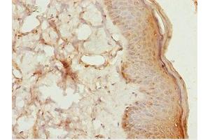 Immunohistochemistry of paraffin-embedded human skin tissue using ABIN7158391 at dilution of 1:100 (LHX6 抗体  (AA 114-363))