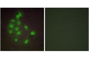 Immunofluorescence analysis of A549 cells, using HAND1 Antibody. (HAND1 抗体  (AA 141-190))
