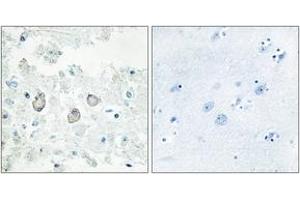 Immunohistochemistry (IHC) image for anti-Docking Protein 7 (DOK7) (AA 10-59) antibody (ABIN6766020) (DOK7 抗体  (AA 10-59))