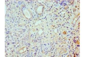 Immunohistochemistry of paraffin-embedded human kidney tissue using ABIN7168003 at dilution of 1:100 (ROCK2 抗体  (AA 1109-1388))