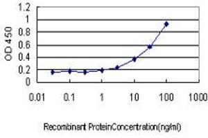 Detection limit for recombinant GST tagged PHKG1 is approximately 1ng/ml as a capture antibody. (PHKG1 抗体  (AA 1-387))