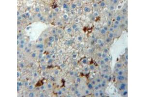 Used in DAB staining on fromalin fixed paraffin-embedded Liver tissue (TJP1 抗体  (AA 1-190))