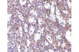 Immunohistochemistry of IL-32 in human spleen tissue with IL-32 antibody at 10 μg/ml. (IL32 抗体  (C-Term))