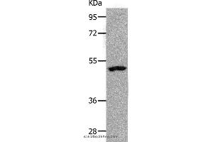 Western blot analysis of Human lymphoma tissue, using NDRG1 Polyclonal Antibody at dilution of 1:1000 (NDRG1 抗体)