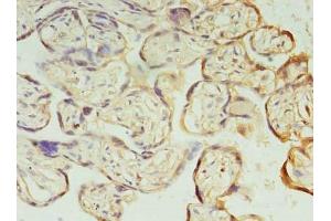 Immunohistochemistry of paraffin-embedded human placenta tissue using ABIN7163449 at dilution of 1:100 (PIH1D1 抗体  (AA 1-290))
