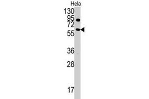 Western blot analysis of ANTXR1 polyclonal antibody  in HeLa cell line lysates (35 ug/lane). (ANTXR1 抗体  (Tyr382))