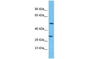 Western Blotting (WB) image for anti-Olfactory Receptor, Family 2, Subfamily F, Member 2 (OR2F2) (C-Term) antibody (ABIN2791722) (OR2F2 抗体  (C-Term))